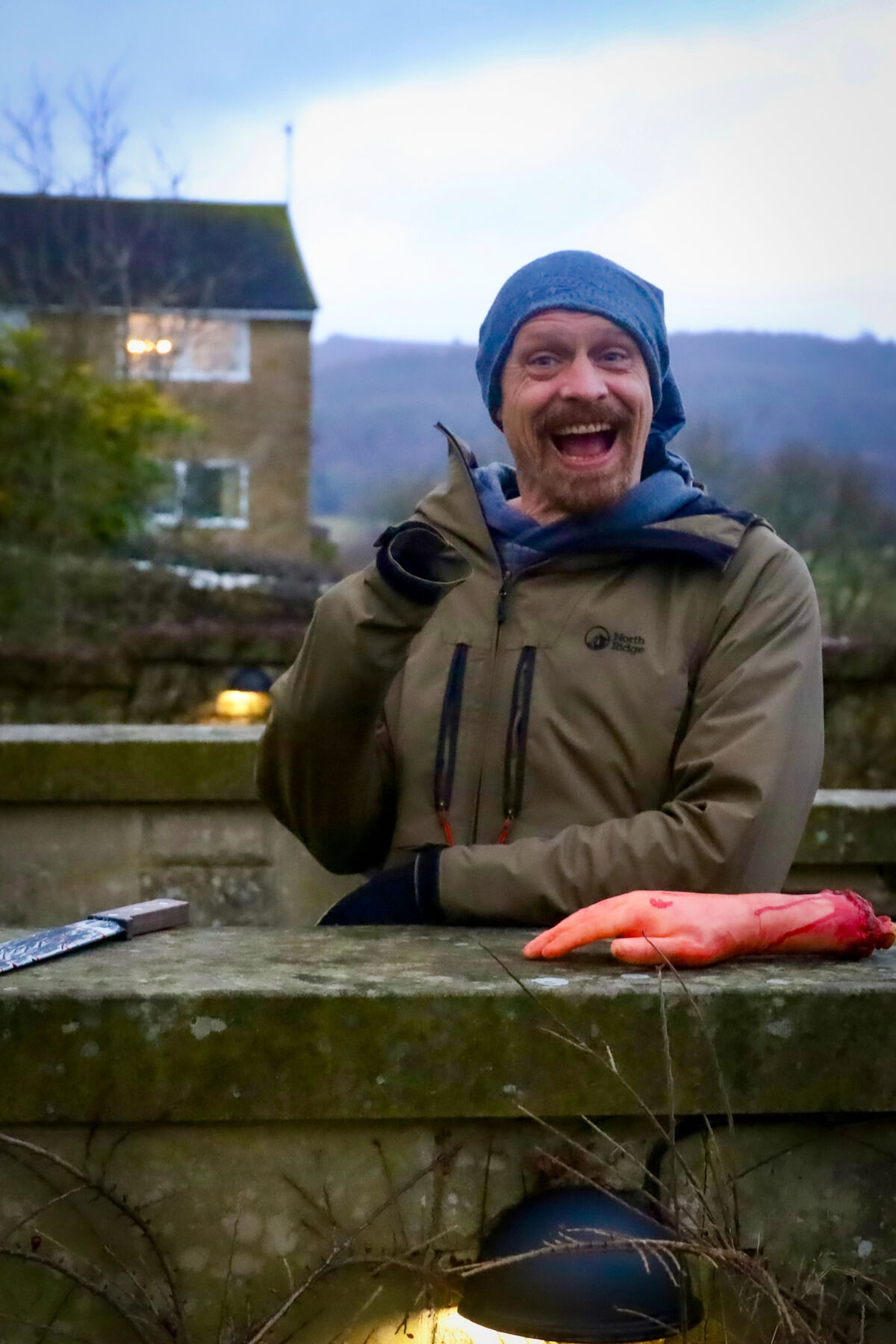 A man with a fake severed hand on a First Aid course.