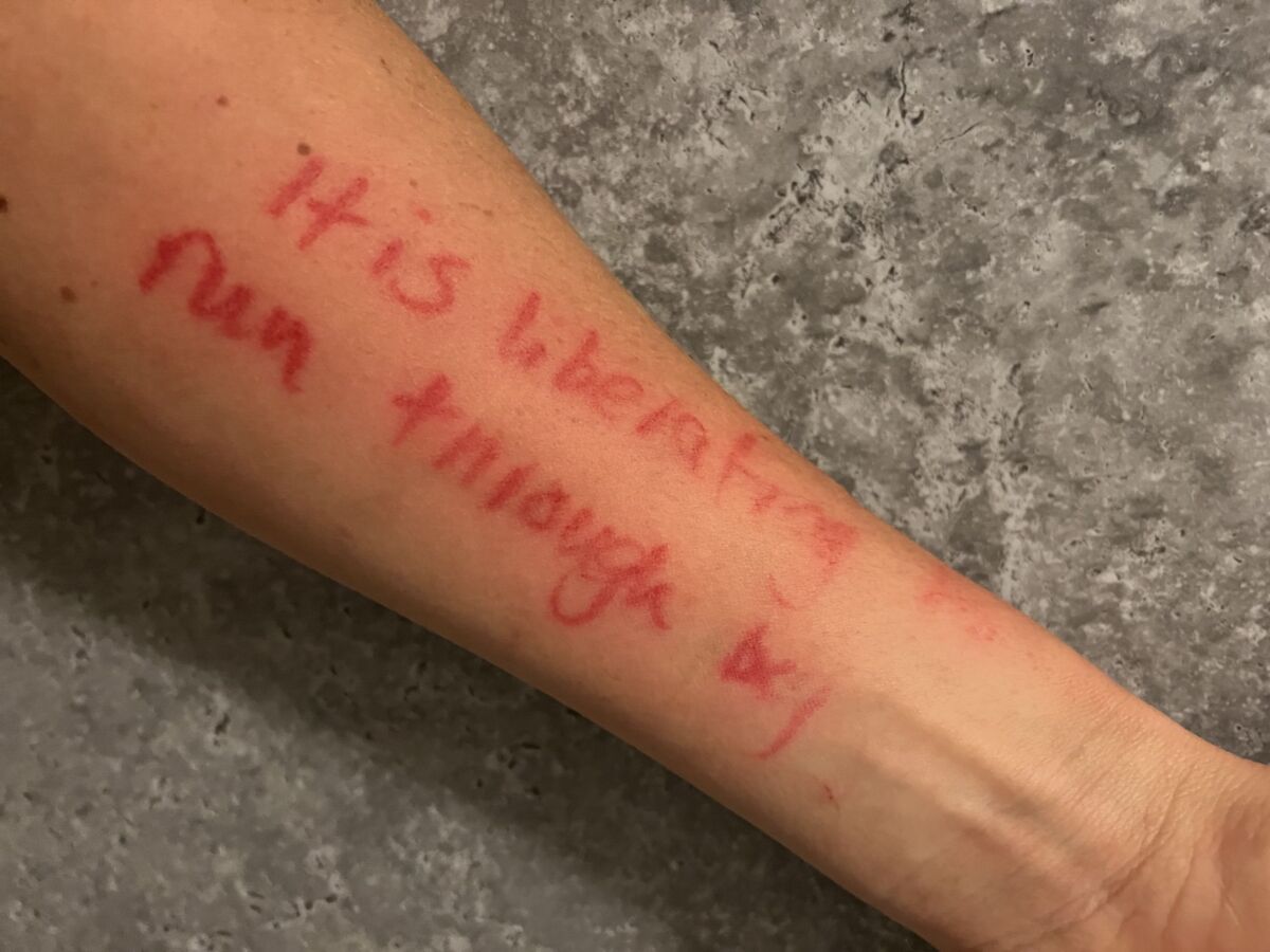 an arm with 'it is liberating to run through bog' written on it